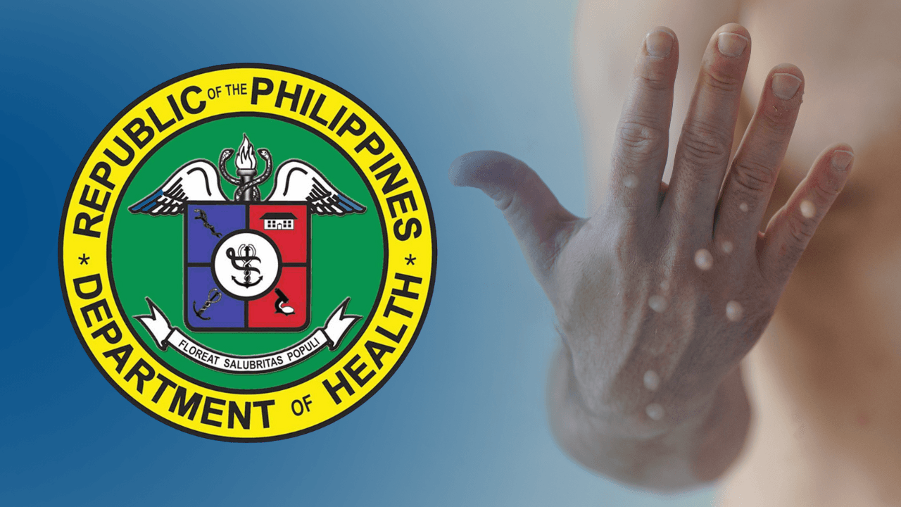 https://newsinfo.inquirer.net/files/2022/07/DOH-Monkeypox.png